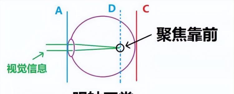 千万别买激光电视（为什么不建议买激光电视）-第4张图片