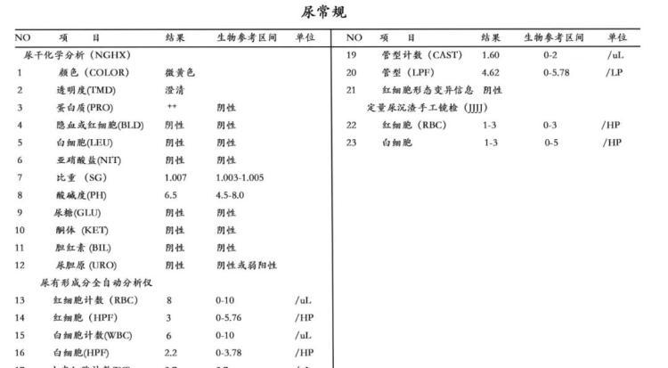 公务员体检尿检千万别用晨尿（尿常规必须晨尿吗）-第1张图片