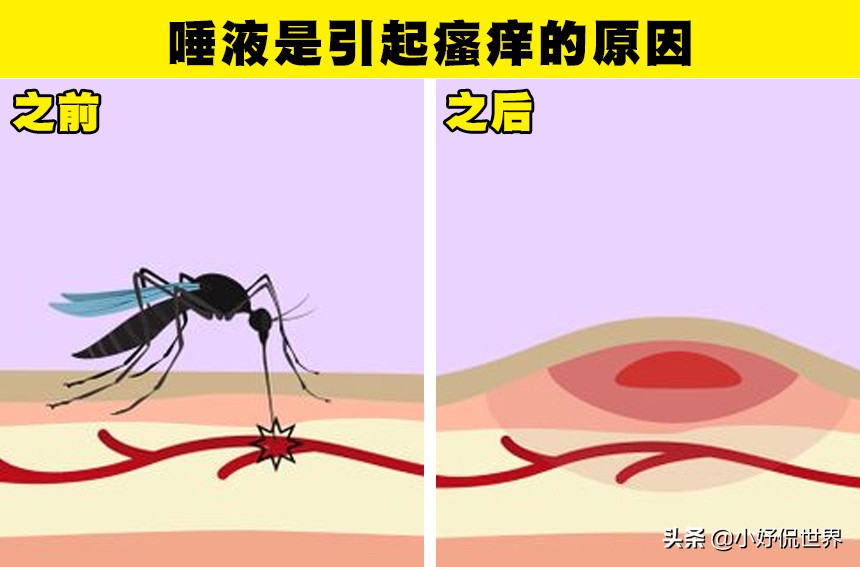 蚊子为什么喜欢在耳边嗡嗡叫（关于蚊子的7个有趣事实）-第7张图片